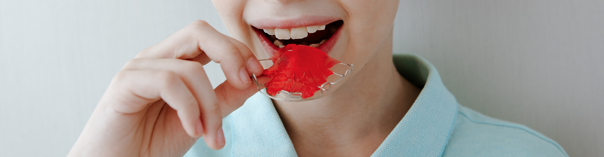Thinking About Straightening Your Teeth? Let’s Talk Removable Plates