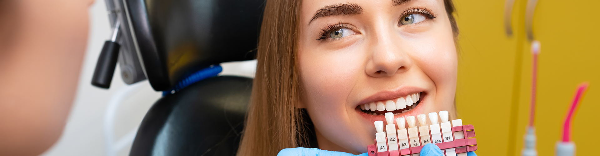 Veneers FAQ: Everything You Need to Know