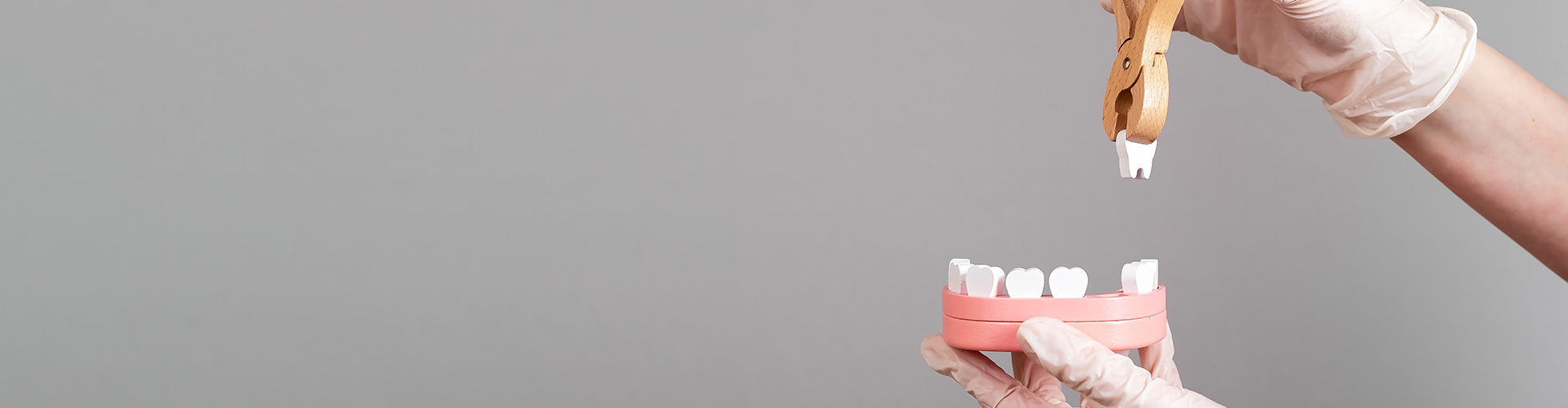 Reasons for Tooth Extraction: Understanding When and Why It’s Necessary