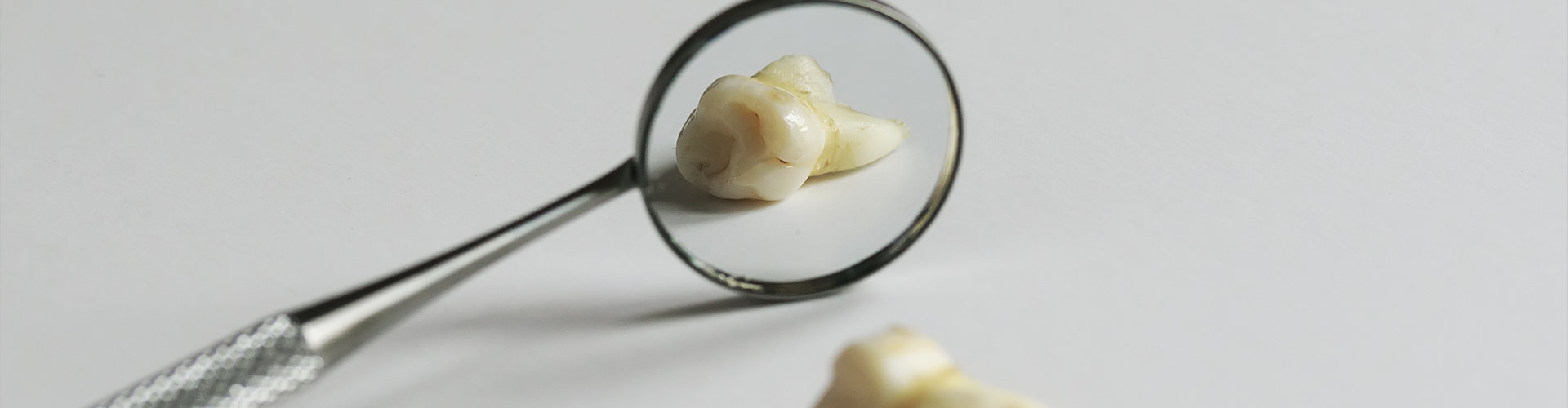 3 Tooth Loss Warnings You Should Never Overlook