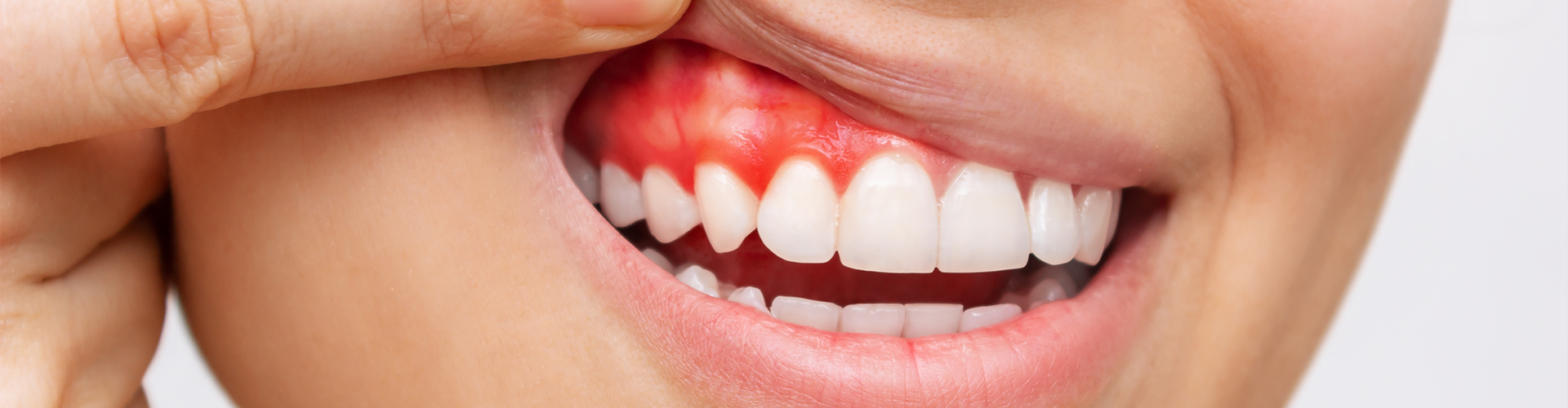 Struggling with Gum Pain? Here’s What You Need to Know