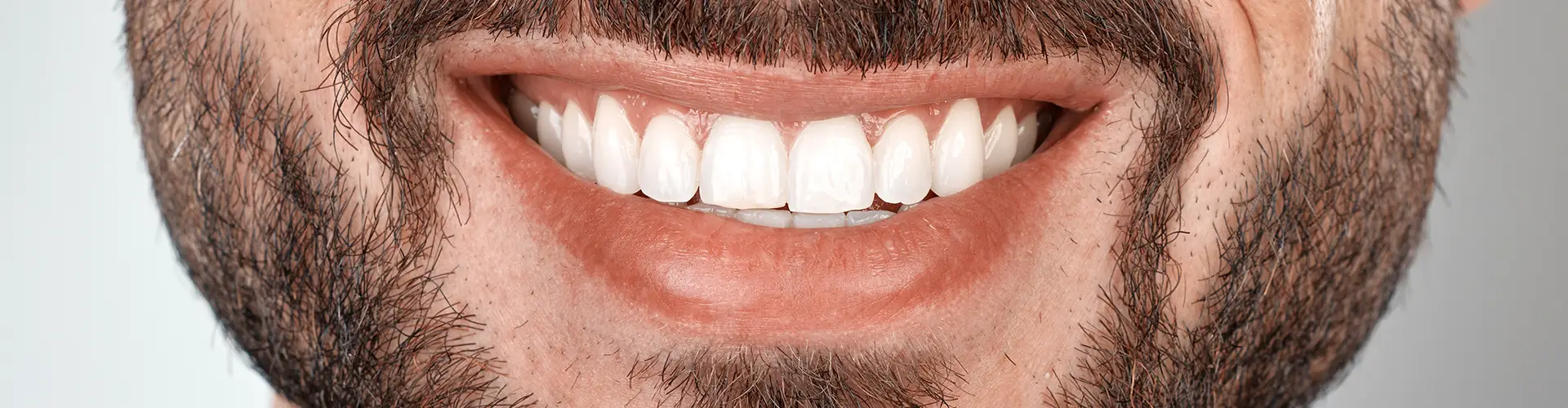 Brighten Your Smile At Home: How Take-Home Whitening Can Work Wonders