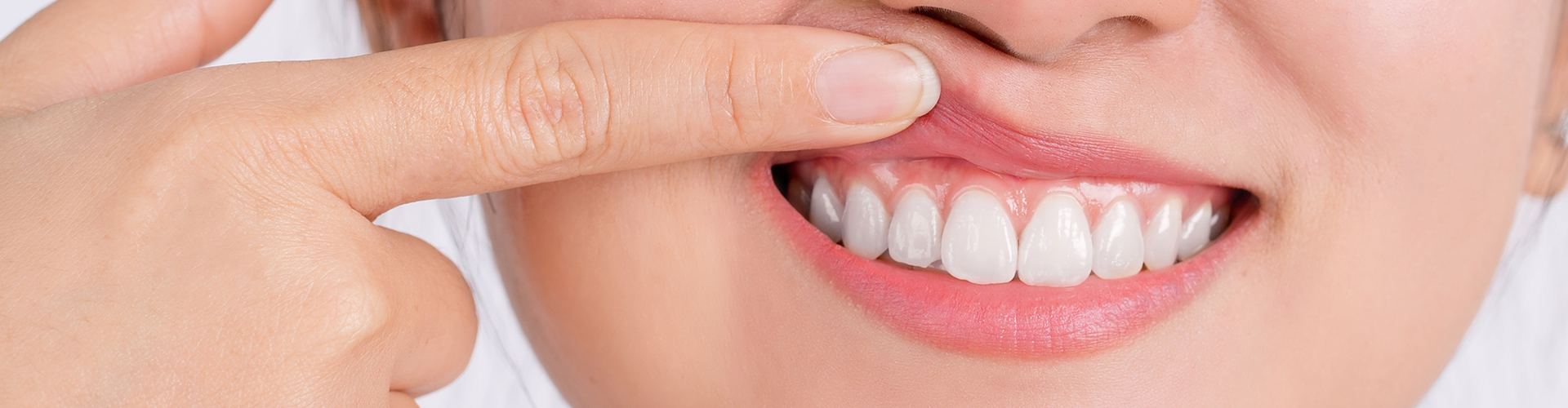 Unlocking the Secrets to Healthier Gums: The Ultimate Guide to Scaling and Root Planing