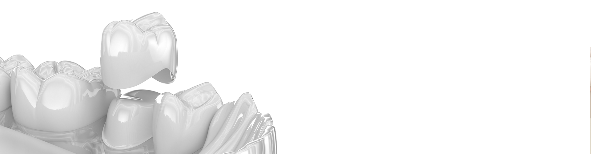 How a Dental Crown Restores Your Tooth