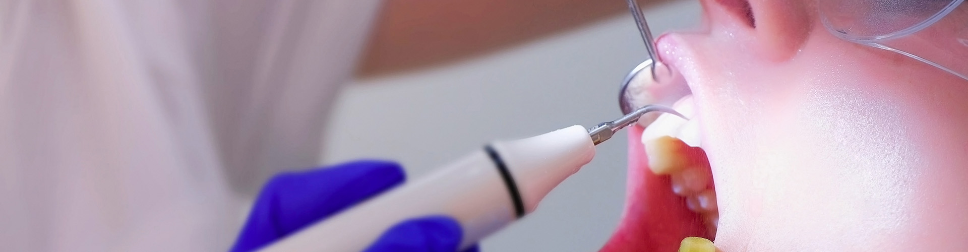 The Crucial Role of Prophylaxis Cleaning in Maintaining Overall Health